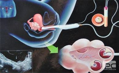 青碧生殖医学中心